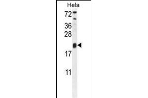 TRPC3 Antibody (N-term) 10175a western blot analysis in Hela cell line lysates (35 μg/lane). (TRAPPC3 antibody  (N-Term))