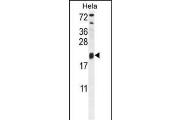 TRAPPC3 antibody  (N-Term)