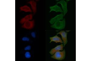 ABIN6257892 and ABIN6274756 staining Hela cells by IF/ICC. (RPS4X antibody  (Internal Region))