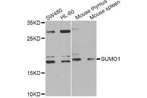 Western blot analysis of extracts of various cell lines, using SUMO1 Antibody (ABIN5971157) at 1/1000 dilution. (SUMO1 antibody)