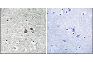 Immunohistochemistry analysis of paraffin-embedded human brain, using IRAK1 (Phospho-Ser376) Antibody. (IRAK1 antibody  (pSer376))