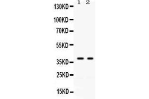 Western blot analysis of GAL4 expression in SW620 whole cell lysates ( Lane 1) and COLO320 whole cell lysates ( Lane 2).