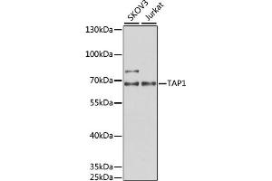 Western blot analysis of extracts of various cell lines, using T antibody (ABIN6131162, ABIN6148845, ABIN6148846 and ABIN6221804) at 1:1000 dilution. (TAP1 antibody  (AA 524-808))