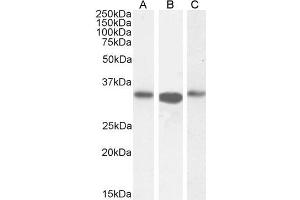 ARPC2 antibody  (C-Term)