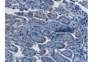 Detection of EDN1 in Human Stomach Tissue using Monoclonal Antibody to Endothelin 1 (EDN1) (Endothelin 1 antibody  (AA 53-90))