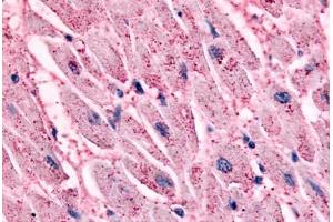 Immunohistochemistry (IHC) image for anti-Adrenergic, beta-2-, Receptor, Surface (ADRB2) (Transmembrane Domain) antibody (ABIN1048318)