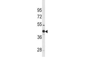 Western Blotting (WB) image for anti-Wingless-Type MMTV Integration Site Family, Member 4 (WNT4) (AA 211-239) antibody (ABIN3029633)