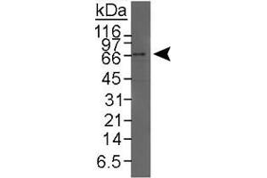 Western blot analysis of NR1H4 in HeLa nuclear extract using NR1H4 polyclonal antibody . (NR1H4 antibody  (C-Term))