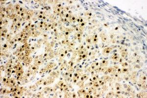 Anti-MTA1 antibody, IHC(F) IHC(F): Rat Ovary Tissue (MTA1 antibody  (C-Term))