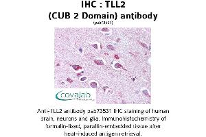 Image no. 1 for anti-Tolloid-Like 2 (TLL2) antibody (ABIN1740102) (Tolloid-Like 2 antibody)
