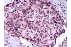 Flow Cytometry (FACS) image for anti-Myocyte Enhancer Factor 2C (MEF2C) (AA 1-125) antibody (ABIN1846463)