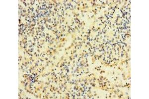 Immunohistochemistry of paraffin-embedded human spleen tissue using ABIN7167200 at dilution of 1:100 (RAC2 antibody  (AA 1-189))