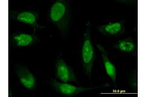 Immunofluorescence of monoclonal antibody to ZNF181 on HeLa cell. (ZNF181 antibody  (AA 354-461))