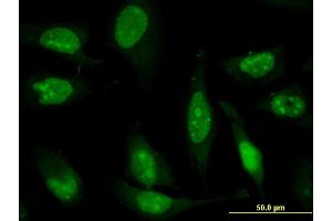 Immunofluorescence of monoclonal antibody to ZNF181 on HeLa cell. (ZNF181 antibody  (AA 354-461))