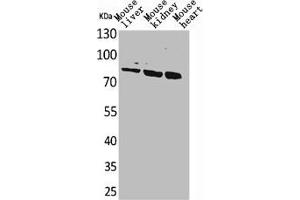 Western Blot analysis of mouse liver mouse kidney mouse heart cells using CUL-4B Polyclonal Antibody