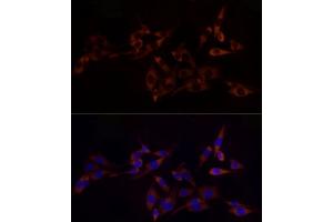 Immunofluorescence analysis of PC-12 cells using RPL10A Rabbit mAb (ABIN7269992) at dilution of 1:100 (40x lens). (RPL10A antibody)
