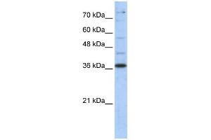 WB Suggested Anti-GAPDH Antibody Titration:  0. (GAPDH antibody  (Middle Region))