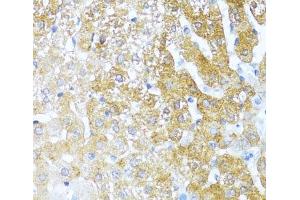 Immunohistochemistry of paraffin-embedded Rat liver using SERPINA3 Polyclonal Antibody at dilution of 1:100 (40x lens). (SERPINA3 antibody)