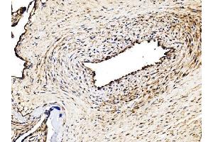 IHC analysis of Glycogen synthase 1/GYS1 using anti-Glycogen synthase 1/GYS1 antibody (ABIN7602155). (Glycogen Synthase 1 antibody  (AA 60-640))
