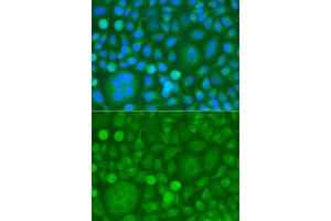 Immunofluorescence analysis of HeLa cells using EPM2A antibody (ABIN5974214). (EPM2A antibody)