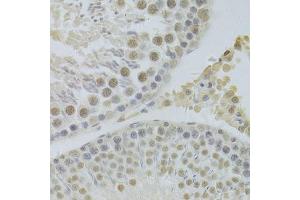 Immunohistochemistry of paraffin-embedded rat testis using HDGF Antibody. (HDGF antibody  (AA 1-240))