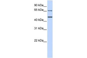 WB Suggested Anti-IRF6 Antibody Titration:  0. (IRF6 antibody  (N-Term))