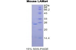 SDS-PAGE analysis of Mouse Laminin alpha 4 Protein.