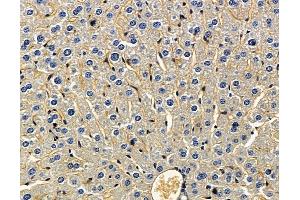 RFLNB Antibody at 1/100 staining mouse liver tissue by IHC-P. (Refilin-B (RFLNB) antibody)
