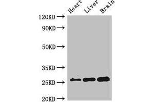 Western Blot Positive WB detected in: Mouse heart tissue, Mouse liver tissue, Mouse brain tissue All lanes: RND2 antibody at 2 μg/mL Secondary Goat polyclonal to rabbit IgG at 1/50000 dilution Predicted band size: 26 kDa Observed band size: 26 kDa (RND2 antibody  (AA 104-163))