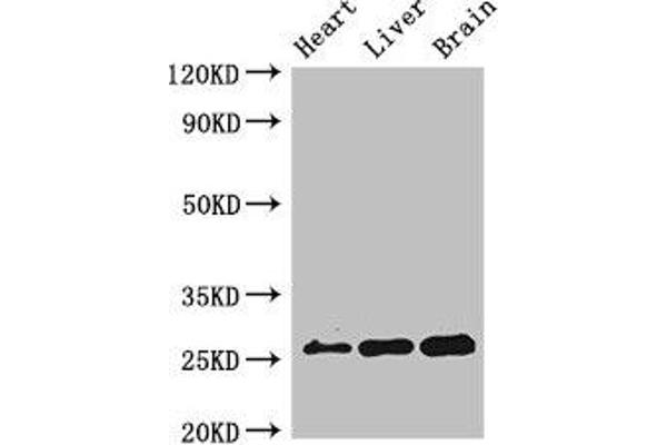 RND2 anticorps  (AA 104-163)