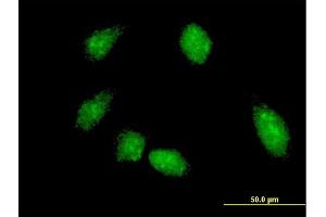 Immunofluorescence of monoclonal antibody to FLI1 on HeLa cell. (FLI1 antibody  (AA 1-452))