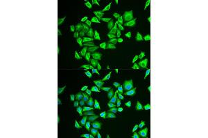 Immunofluorescence (IF) image for anti-Phosphoglucomutase 1 (PGM1) antibody (ABIN1980319) (Phosphoglucomutase 1 antibody)