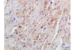 Immunohistochemistry (IHC) image for anti-Syntrophin, beta 1 (Dystrophin-Associated Protein A1, 59kDa, Basic Component 1) (SNTB1) (AA 51-150) antibody (ABIN1714481)