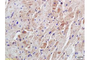 Formalin-fixed and paraffin embedded mouse heart labeled with Anti-Syntrophin-2 Polyclonal Antibody, Unconjugated (ABIN1714481) at 1:200 followed by conjugation to the secondary antibody and DAB staining (SNTB1 antibody  (AA 51-150))