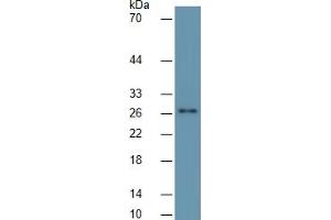 Western Blotting (WB) image for Cardiac Troponin I (TNNI3) ELISA Kit (ABIN6730900)