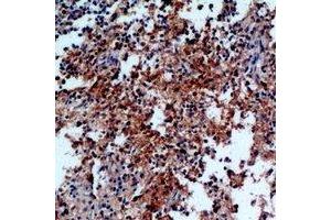 Immunohistochemical analysis of IL-31 staining in human spleen formalin fixed paraffin embedded tissue section.