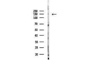 anti-Mov10l1, Moloney Leukemia Virus 10-Like 1 (MOV10L1) (Internal Region) antibody