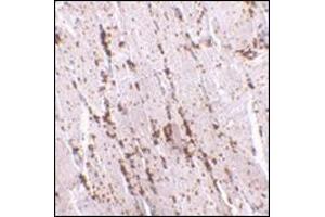 Immunohistochemistry of LIMP2 in human skeletal muscle with this product at 2. (SCARB2 antibody  (Center))
