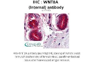Image no. 1 for anti-Wingless-Type MMTV Integration Site Family, Member 8A (WNT8A) (Internal Region) antibody (ABIN1740838)