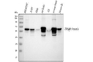 Western blot analysis of Alpha Internexin using anti-Alpha Internexin antibody (ABIN4886634). (INA antibody  (AA 71-161))
