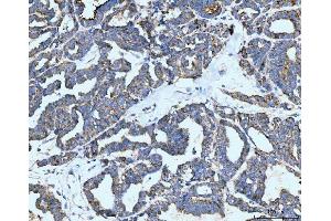 IHC analysis of Neurofibromin/NF1 using anti-Neurofibromin/NF1 antibody (ABIN7600197).