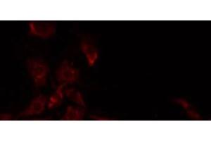 ABIN6277840 staining Hela by IF/ICC. (CD22 antibody)