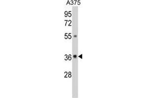 Western blot analysis of GALE Antibody (Center) in A375 cell line lysates (35 µg/lane). (GALE antibody  (Middle Region))
