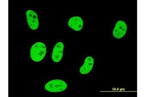 Immunofluorescence of monoclonal antibody to SMAD3 on HeLa cell. (SMAD3 antibody  (AA 147-270))