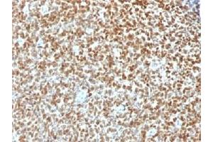 IHC testing of FFPE Ewings sarcoma with recombinant NKX2.