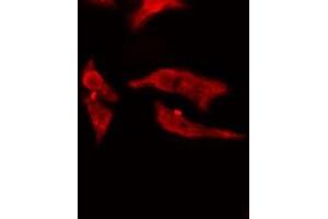 ABIN6275022 staining  Hela cells by IF/ICC. (RCL antibody  (N-Term))