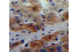 Used in DAB staining on fromalin fixed paraffin-embedded Liver tissue (LAMa4 antibody  (AA 832-1039))