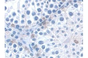 Immunohistochemistry (IHC) image for anti-WW and C2 Domain Containing 1 (WWC1) (AA 847-1094) antibody (ABIN7441667)