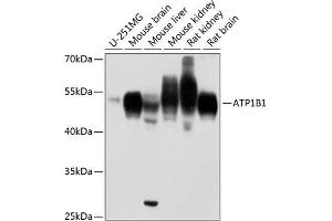 Western blot analysis of extracts of various cell lines, using B1 antibody (ABIN6127387, ABIN6137304, ABIN6137307 and ABIN6216023) at 1:1000 dilution. (ATP1B1 antibody  (AA 65-240))