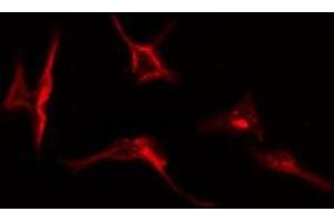 ABIN6277063 staining  HepG2 cells by IF/ICC. (FGFR1 antibody  (C-Term))